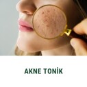 Akne Tonik